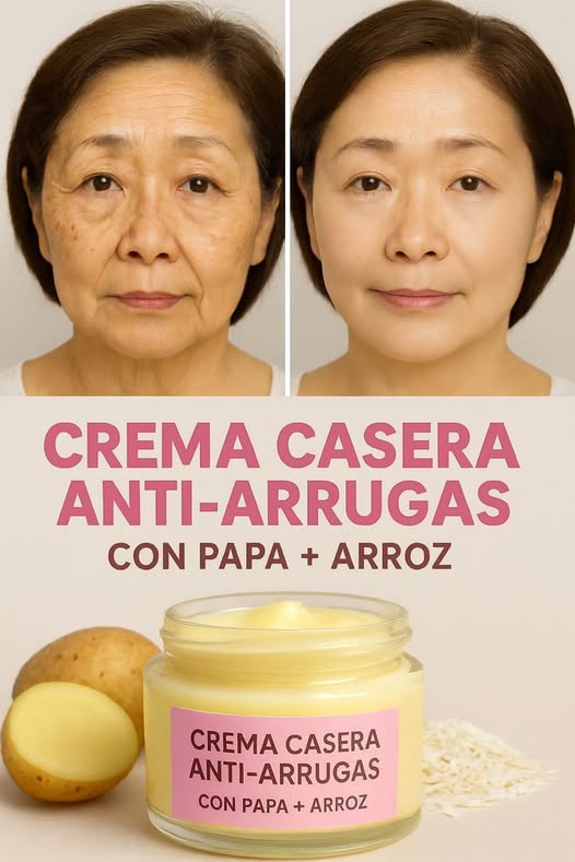 Crema Casera Antiarrugas con Papa y Arroz