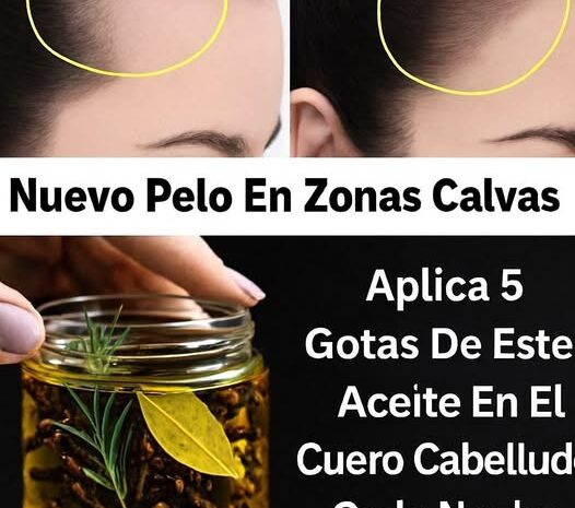 Aceite Regenerador Capilar con Romero Clavos y Laurel para el Crecimiento del Cabello