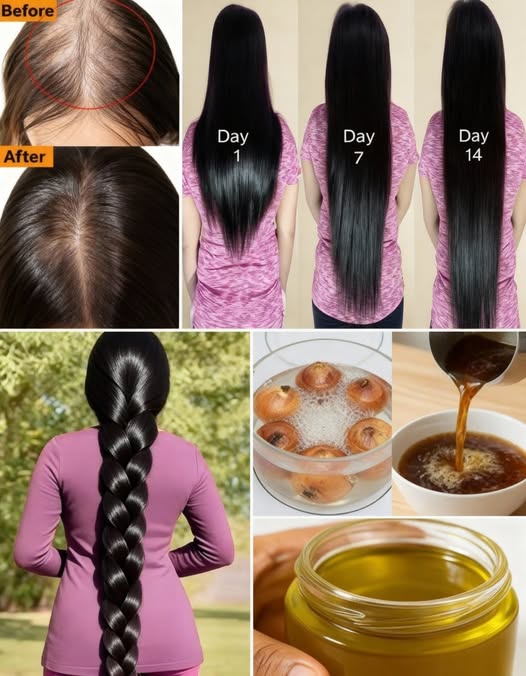 Cuidado del cabello