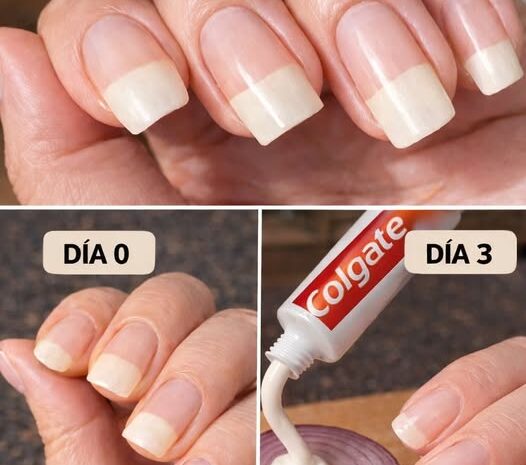 Fortalece y Blanquea tus Uñas con esta Receta Casera Efectiva
