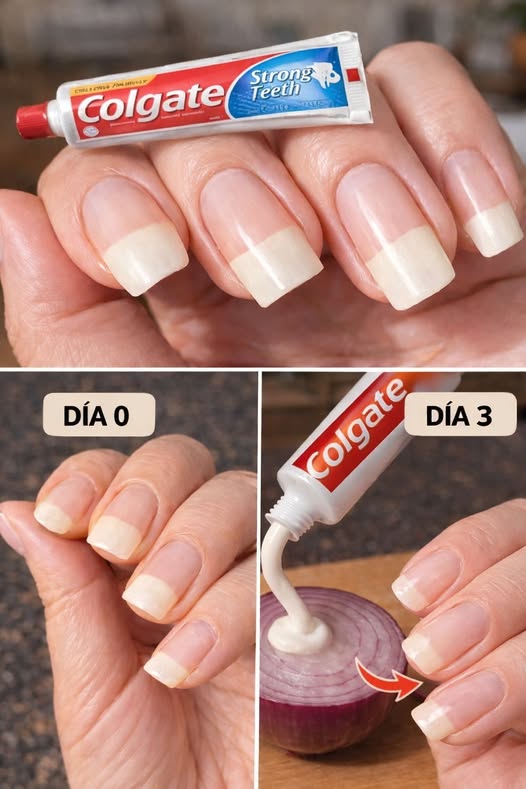 Tratamiento casero para las uñas