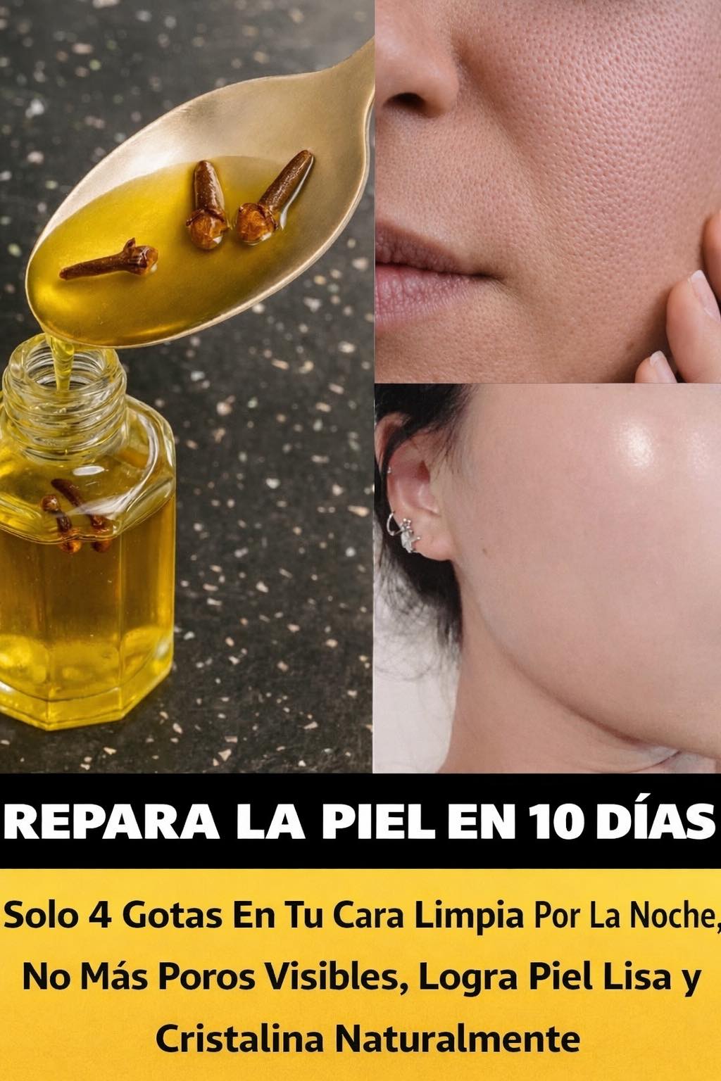 Aceite de clavo para la piel