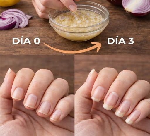 Cómo Hacer Crecer las Uñas en Tres Días con Cebolla y Ajo