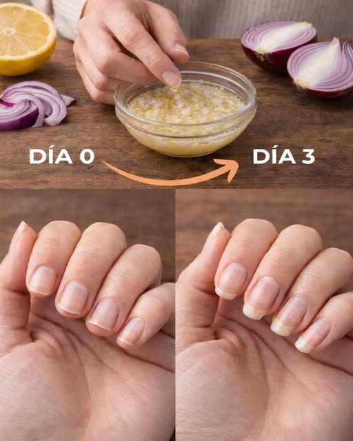 Remedio casero para el crecimiento de uñas