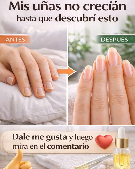 Antes y después del tratamiento para uñas