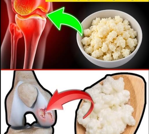 Alimentos Para El Alivio Articular y Reducción de Hinchazón