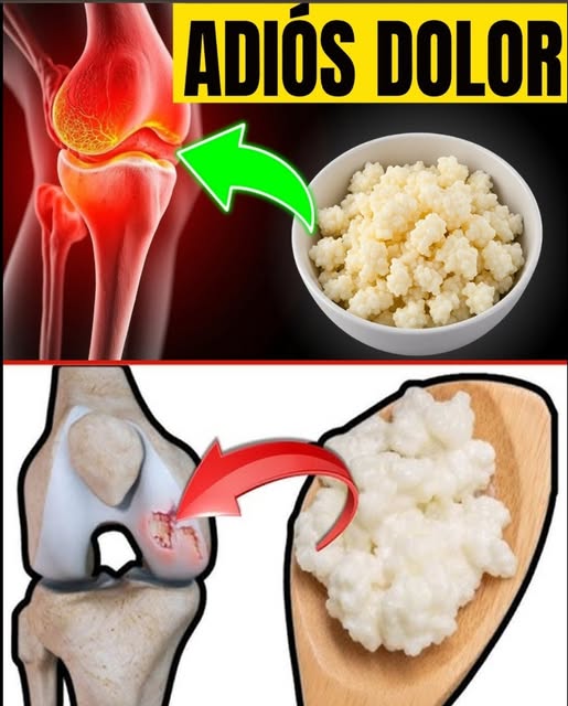 Kéfir como remedio para el dolor articular