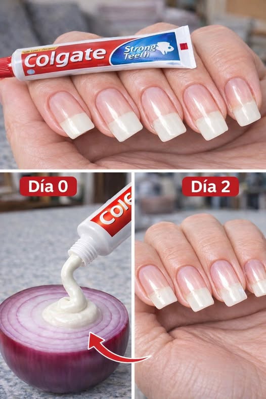 Remedio Casero para Fortalecer Uñas