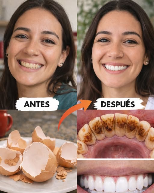Antes y Después de blanquear dientes con cáscaras de huevo