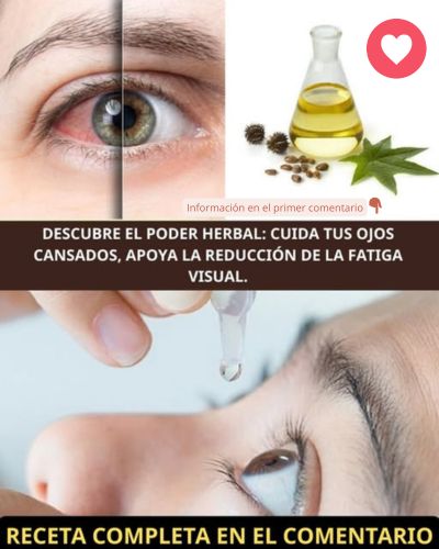 Cuidado de los ojos con remedios naturales