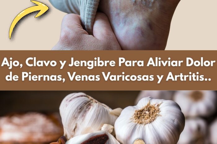 Alivio Natural para Piernas con Venas Varicosas