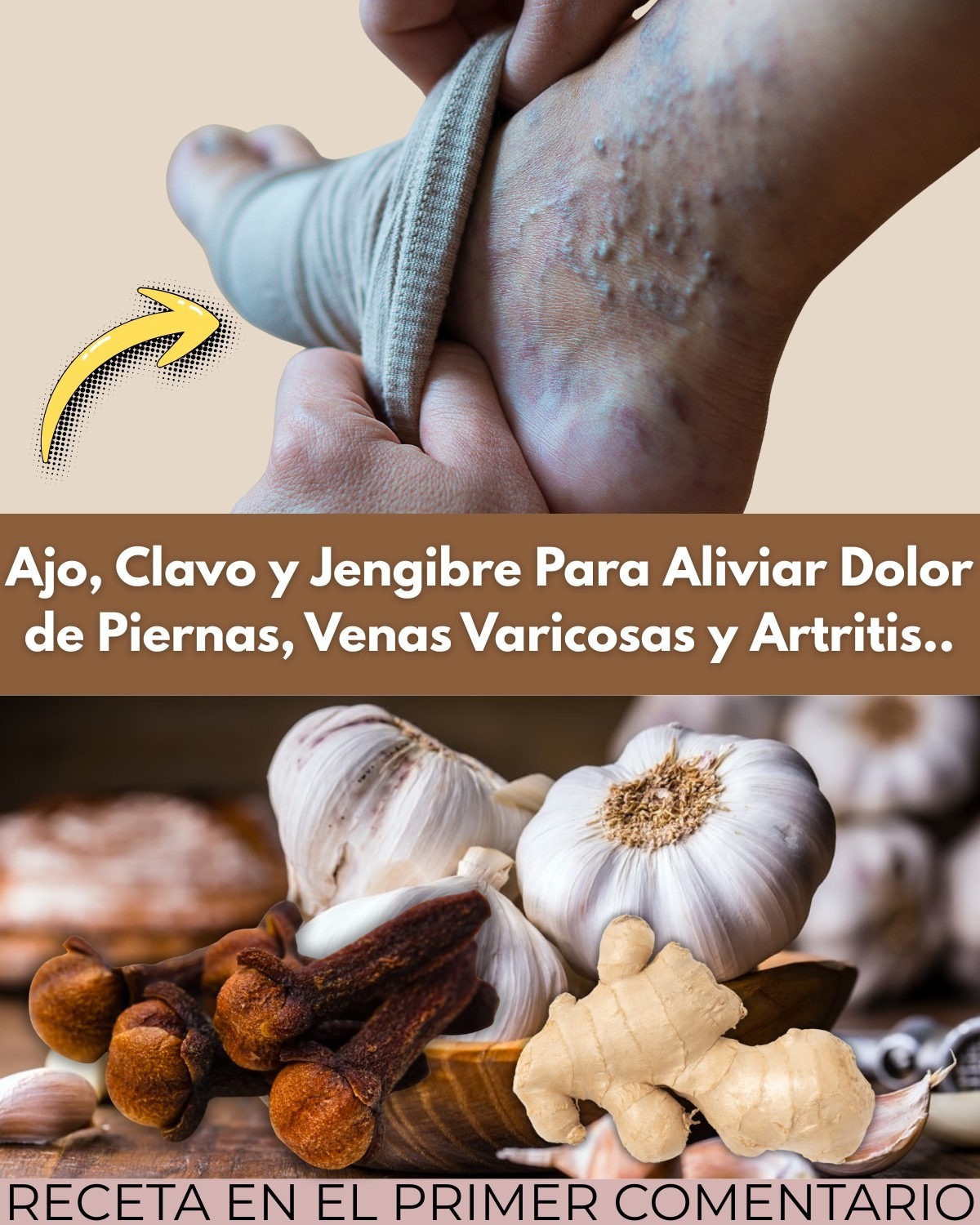 Ingredientes naturales para aliviar dolor de piernas