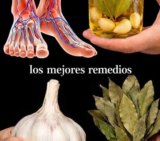 Aceite Natural de Ajo y Laurel para Mejorar la Circulación y Aliviar Venas Varicosas
