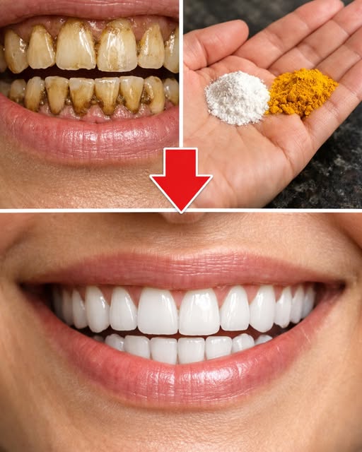 Remedios naturales para blanquear los dientes