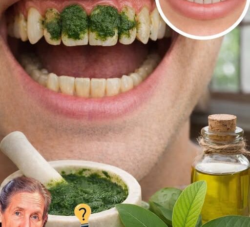 Las 3 Mejores Maneras de Tratar la Caries Dental con Hojas de Guayaba