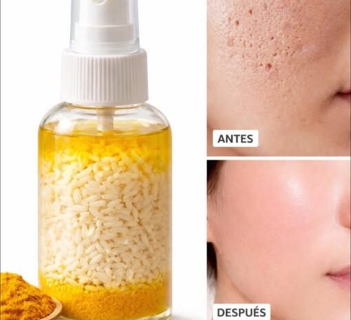 Transforma Tu Piel Con Esta Crema Natural Para Poros Dilatados Y Espinillas