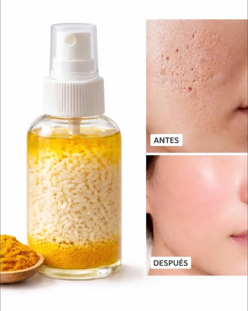 Antes y Después de Usar Crema Natural para la Piel