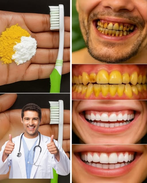 Métodos Naturales para Blanquear los Dientes