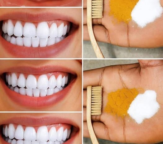 Blanqueamiento Dental Casero Consigue Dientes Más Blancos en Solo 2 Minutos