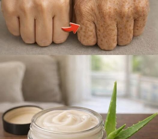 Crema Facial Casera de Aloe Vera para Piel Blanca y Sin Arrugas