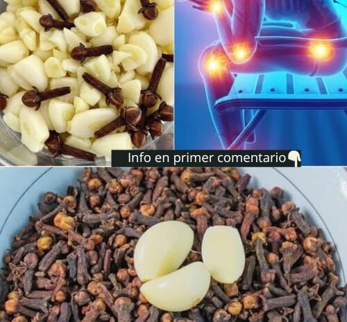 Remedios Naturales: Alivio para Várices y Dolores en las Piernas con Ajo y Clavos de Olor