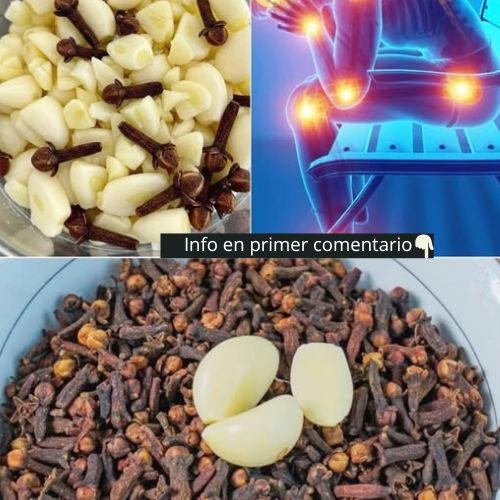 Mezcla de ajo y clavos para aliviar várices