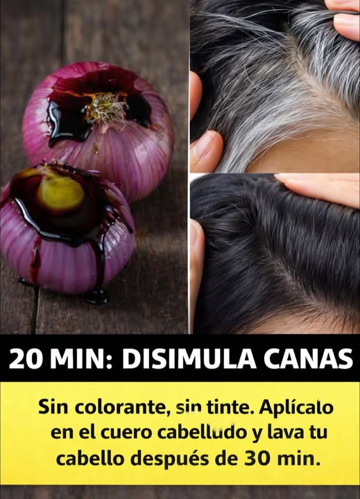 Remedio casero de cebolla para canas