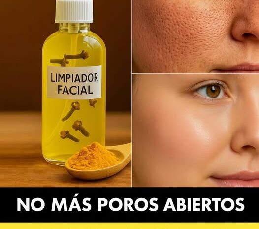 El Limpiador Facial Casero Que Elimina Los Poros Abiertos