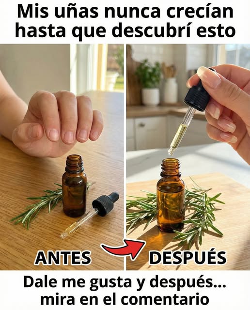 Fotos de uñas antes y después del uso de romero