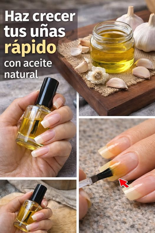 Consejo de belleza para hacer crecer las uñas con aceite de ajo