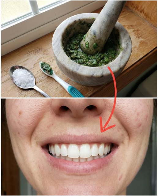 Remedio natural para dientes saludables