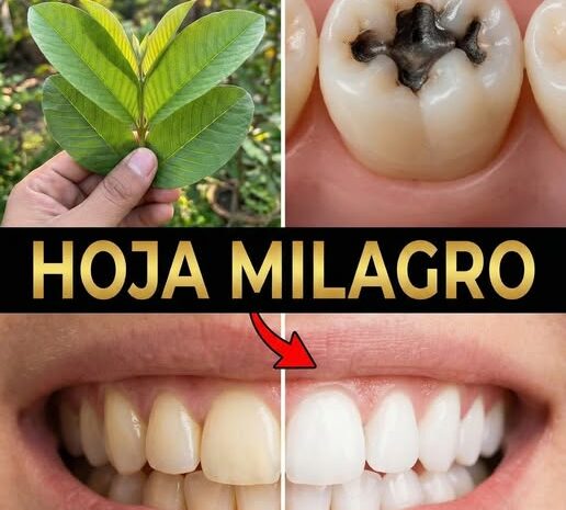 Mejores Maneras de Tratar las Caries con Hojas de Guayaba