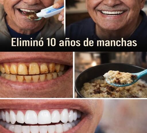 Elimina Manchas en los Dientes de Forma Natural