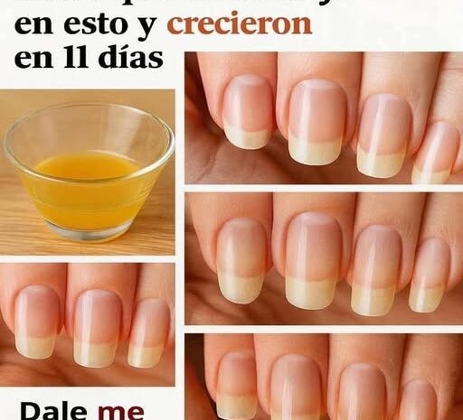 El Poder del Ajo para el Crecimiento y Fortalecimiento de Uñas