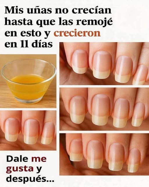 Crecimiento de Uñas con Ajo