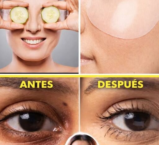 Remedios Naturales para Eliminar Ojeras de Forma Efectiva en Casa