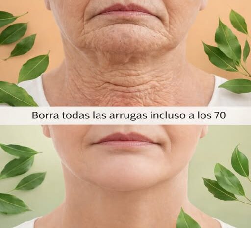 Laurel el Remedio Natural que Borra Arrugas