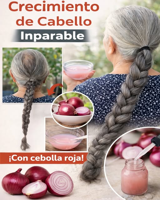 Aceite de Cebolla para el Crecimiento del Cabello