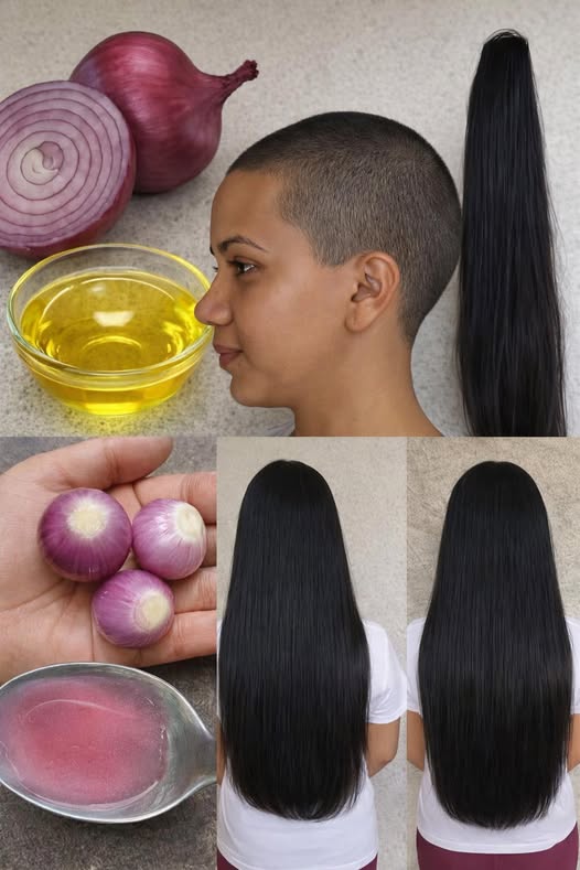 Remedio natural para el cabello con cebolla roja