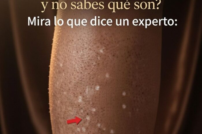 Manchas Blancas en la Piel Causas y Remedios Naturales