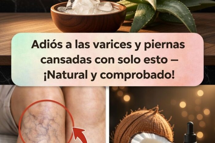 Remedios Naturales para Várices y Piernas Cansadas con Aloe Vera