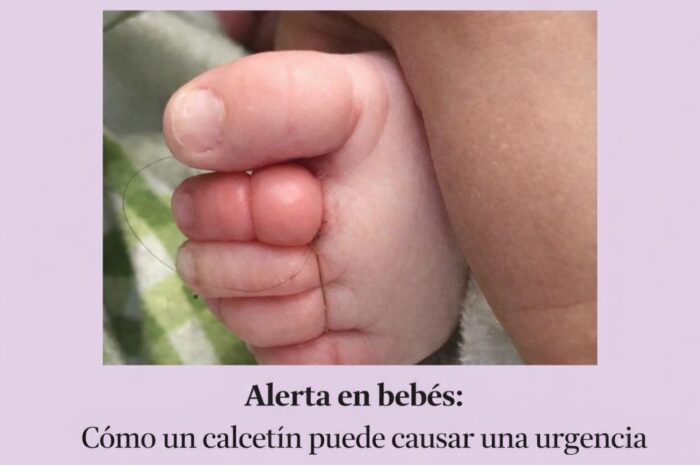 Alerta en bebés: Cómo un calcetín puede causar una urgencia