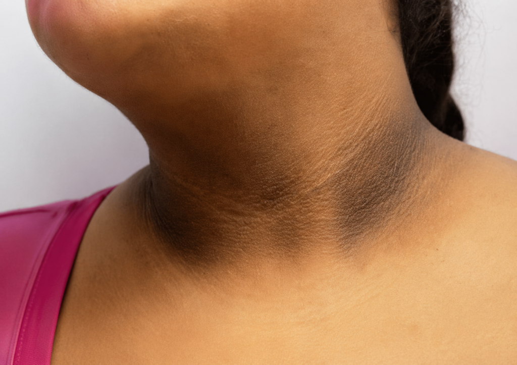 Manchas oscuras en pliegues del cuerpo: señales de alerta de la piel