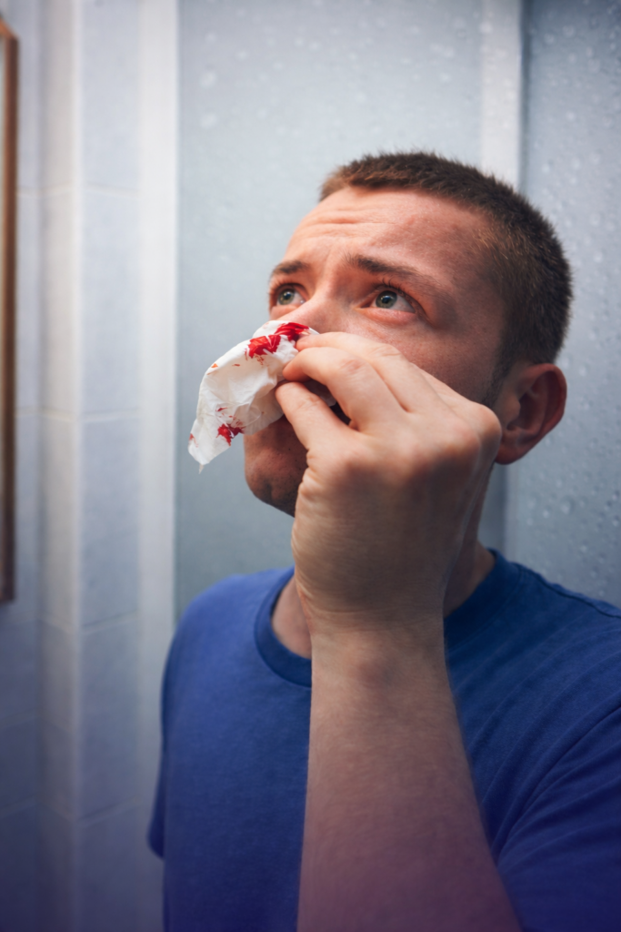Sangrado nasal: causas frecuentes y cuándo es señal de alerta