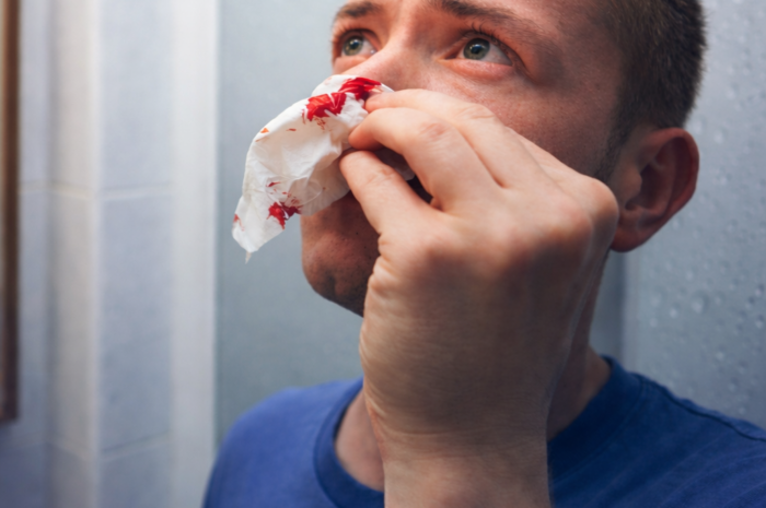 Sangrado nasal: causas frecuentes y cuándo es señal de alerta