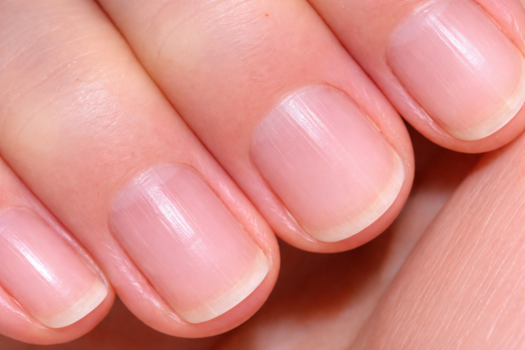 Líneas en las uñas: qué significan y qué dicen sobre tu salud