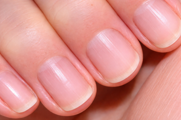 Líneas en las uñas: qué significan y qué dicen sobre tu salud