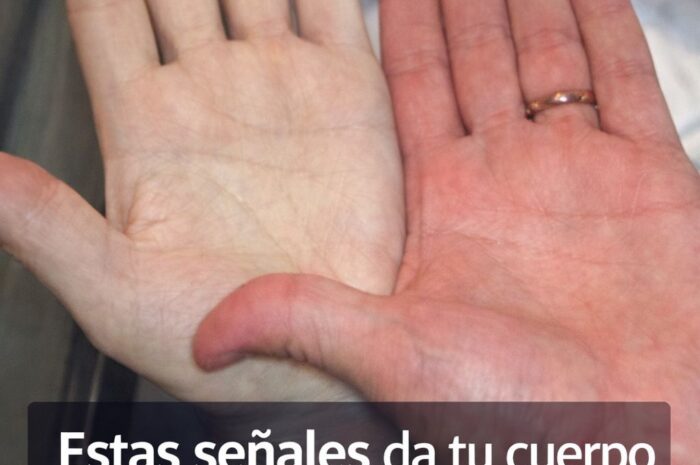 Anemia señales silenciosas: Síntomas por falta de oxígeno