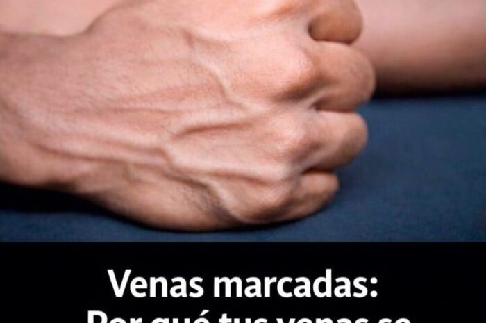 Venas marcadas: Por qué tus venas se ven más visibles
