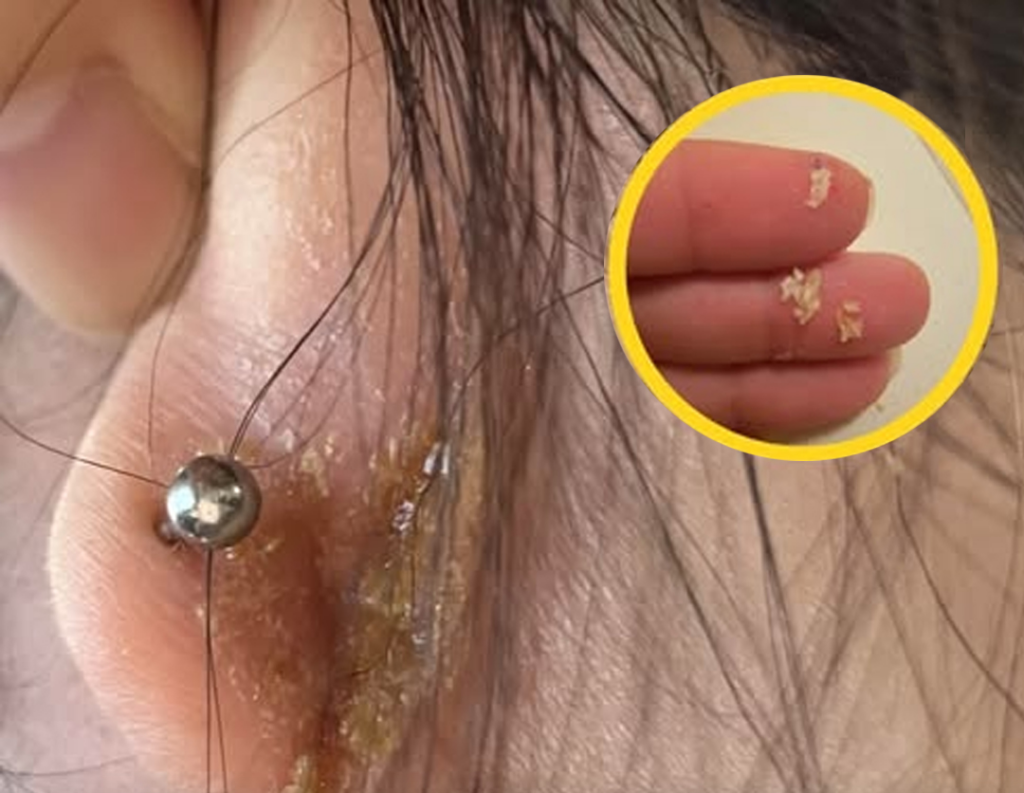 Costras con mal olor detrás de las orejas: causas y tratamiento